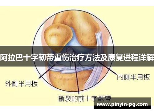 阿拉巴十字韧带重伤治疗方法及康复进程详解 阿拉巴十字韧带重伤治疗方法及康复进程详解